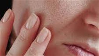 وداعًا للوجه المنتفخ! أسهل الطرق للتخلص من دهون الوجه