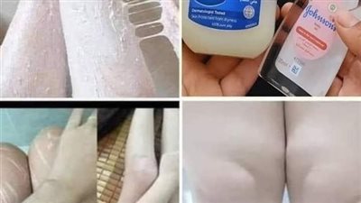  سر خلطة زيت جونسون والفازلين في تبييض الپشرة وإزالة التصبغات بشكل نهائي